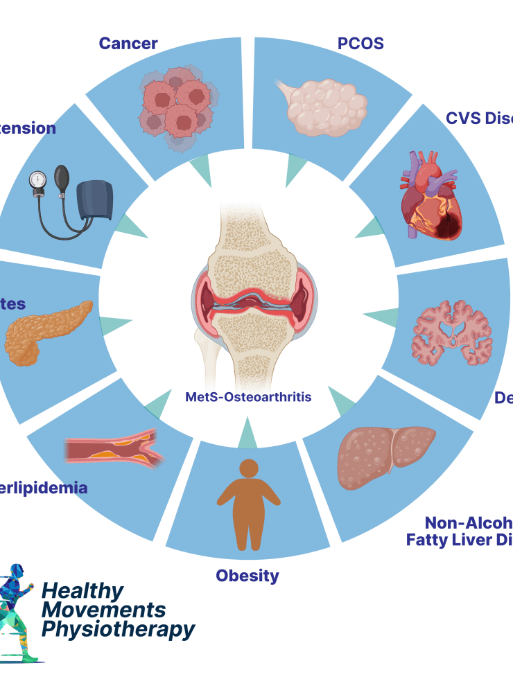 Illustration showing the connection between metabolic syndrome and osteoarthritis, highlighting related conditions like obesity, diabetes, hypertension, cardiovascular disease, and fatty liver.