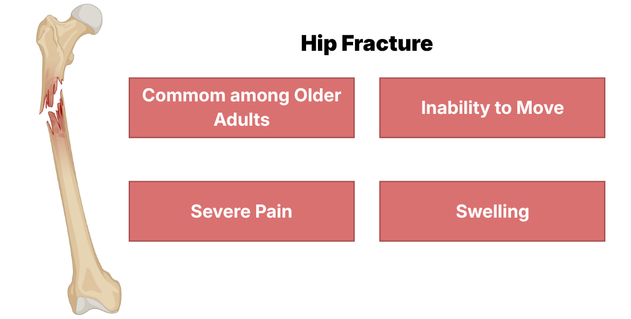 An educational medical infographic titled "Hip Fracture." The left side features an anatomical illustration of a femur bone with a clear fracture breakdown. The right side contains four red text blocks highlighting demographics and symptoms: common among older adults, inability to move, severe pain, and swelling.