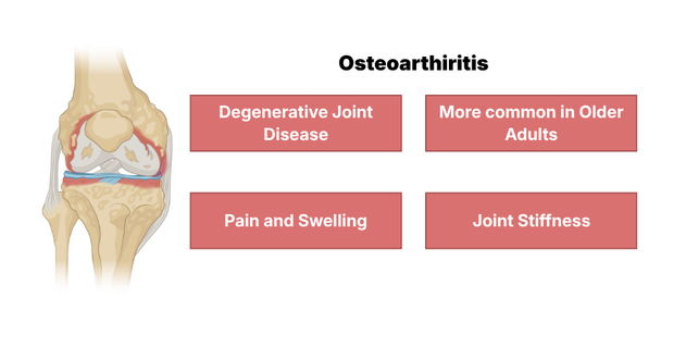 An educational medical graphic titled "Osteo.png" detailing the clinical features of osteoarthritis. The image features a detailed anatomical illustration of a knee joint experiencing cartilage degradation and inflammation on the left, alongside four red text blocks that define the condition as a degenerative joint disease, highlight its prevalence in older adults, and list symptoms like pain, swelling, and joint stiffness.